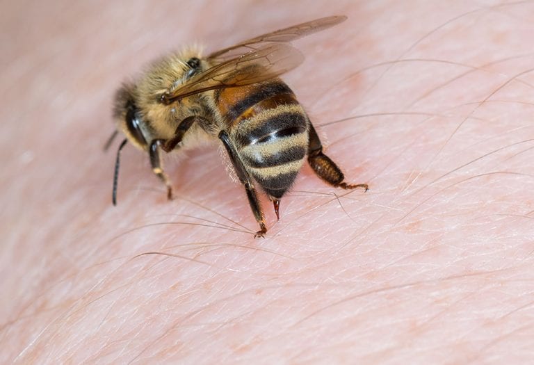 679184698 H 768x525 - العلاجات المنزلية للسعات النحل سوف تساعدك على مكافحة آثاره