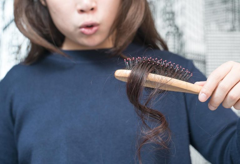 10 علاجات منزلية بسيطة وفعالة تمنع تساقط الشعر - %categories