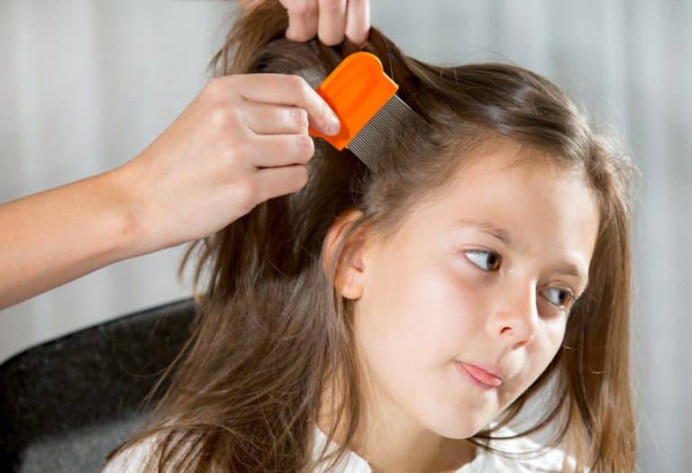 15 علاج منزلي لقمل الرأس عند الأطفال - %categories