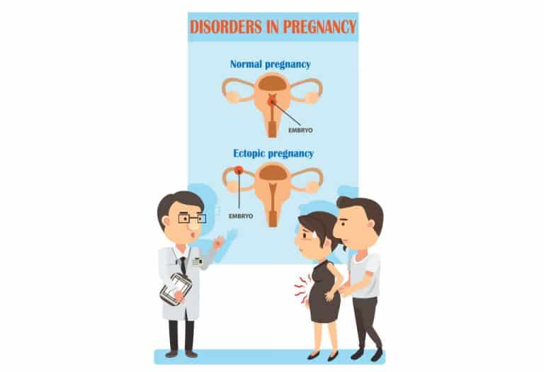 اعراض الحمل خارج الرحم - الأسباب والعلاج - %categories
