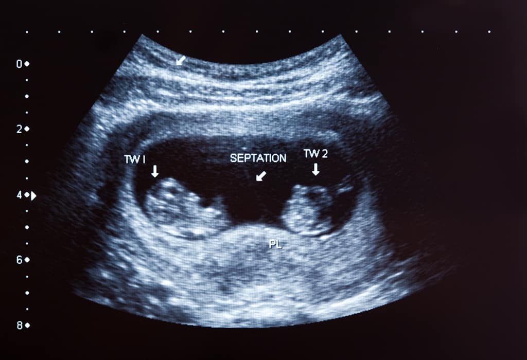 مستويات هرمون (أتش سي جي) أثناء فترة الحمل للحمل بتوأم - %categories