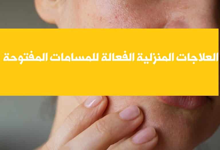 العلاجات المنزلية الفعالة للتخلص من مسامات الوجه نهائياً - %categories