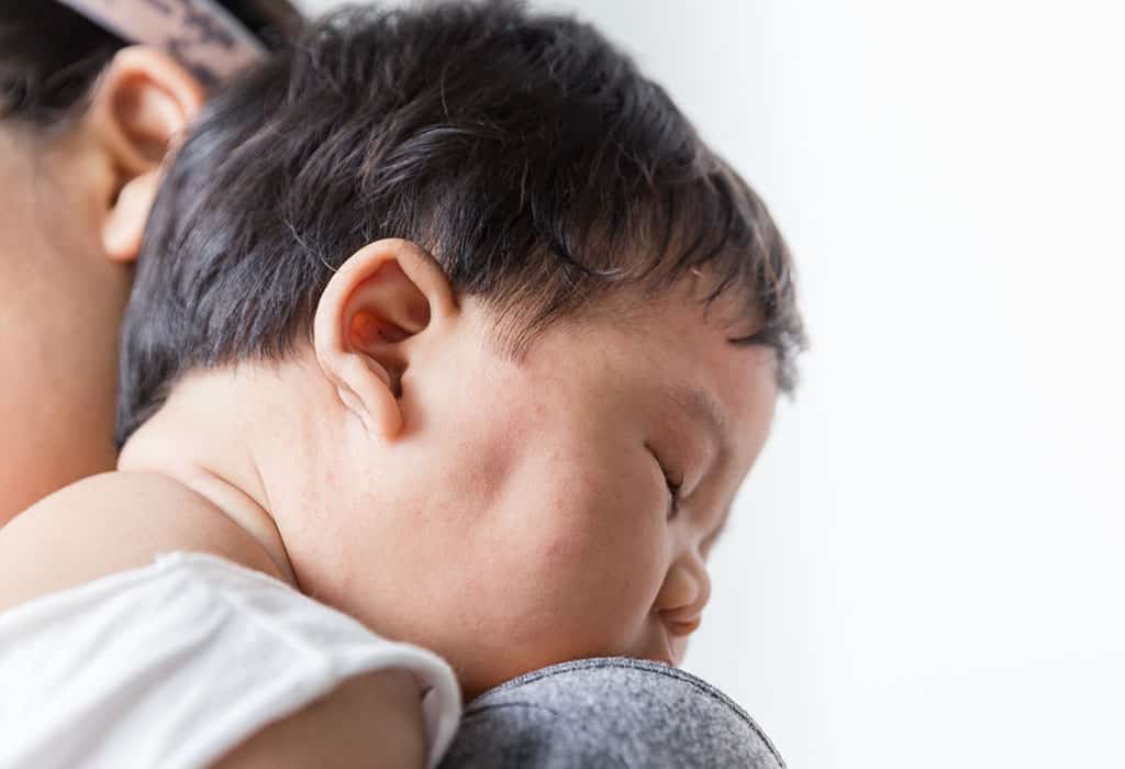 كيفية علاج و منع طفح و تسلخات الرقبة عند الرضع - %categories