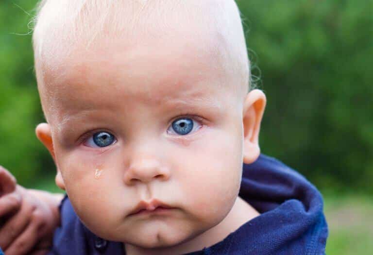 العيون المائية (دماع) لدى الأطفال - %categories