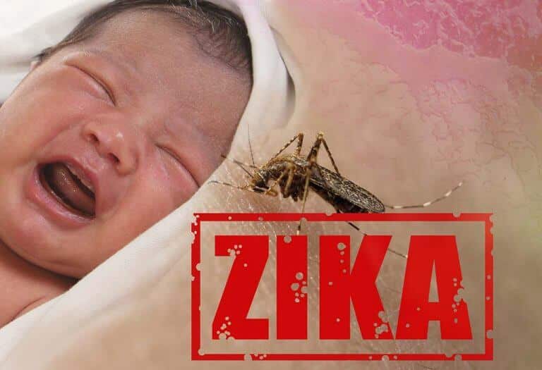 عدوى فيروس زيكا عند الأطفال - %categories