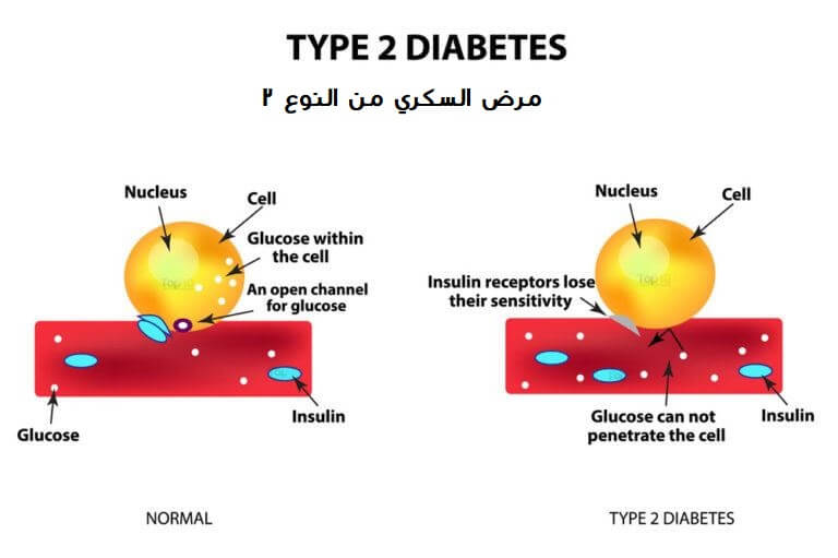 الخطر لمرض السكري من النوع 2 هل أنت في خطر؟ type two diabetes diagram 768x511 - عوامل الخطر لمرض السكري من النوع 2: هل أنت في خطر؟