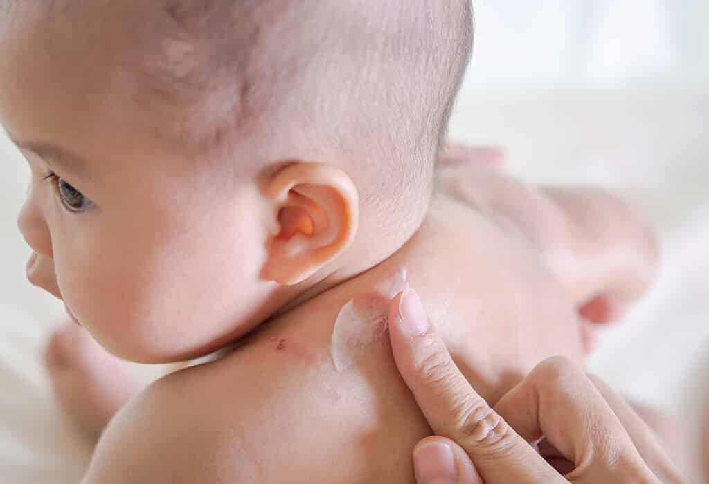هل طارد البعوض آمن على الرضع أم غير آمن؟ - %categories