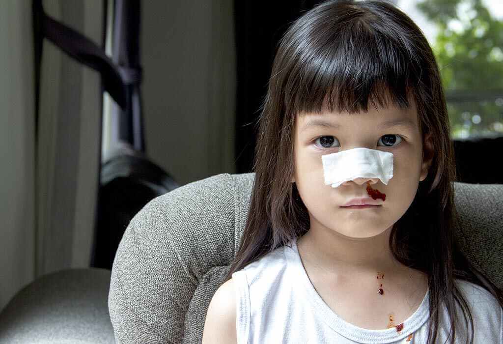 الإسعافات الأولية لـ 10 إصابات شائعة عند الأطفال - %categories