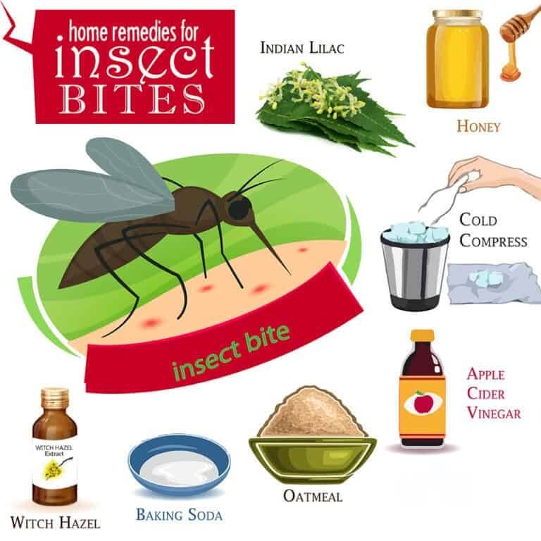العلاجات المنزلية للدغات الحشرات - %categories