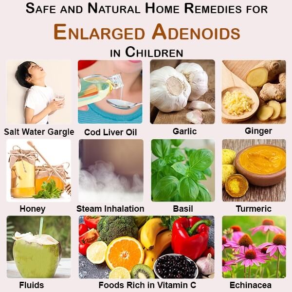 العلاجات المنزلية الآمنة والطبيعية اللحامات الموسعة عند الأطفال - %categories