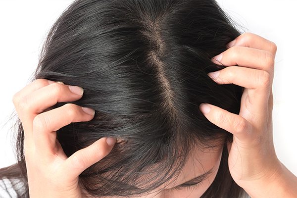 العلاجات المنزلية لفروة الرأس الجافة: ما هو الأفضل ولماذا؟ - %categories