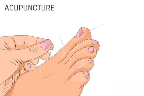 علاج التهاب اصبع القدم الكبير في المنزل - %categories