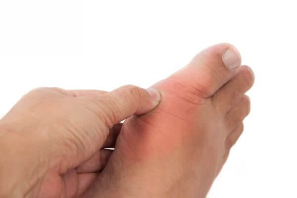 علاج التهاب اصبع القدم الكبير في المنزل - %categories
