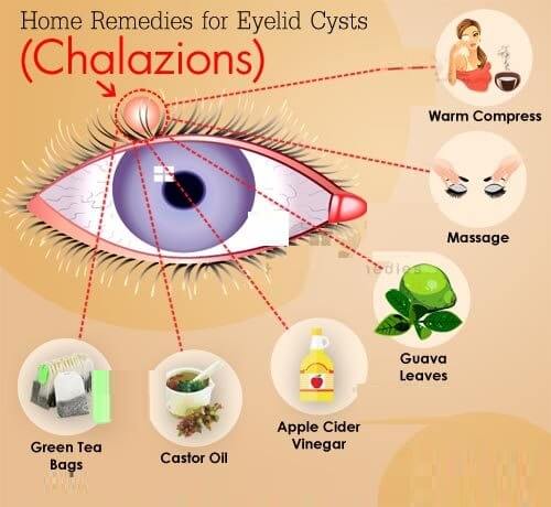 علاج بردة العين بالاعشاب - %categories