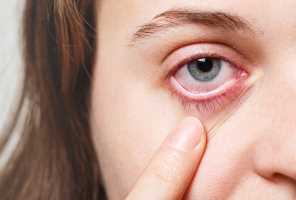 Qu'est-ce que l'œil rose et comment le traiter - soins des yeux oeil rose pour l'exploit - qu'est-ce que l'oeil rose et comment le traiter