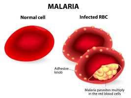 malaria0ل1 - 10 علاجات طبيعية فعالة للملاريا