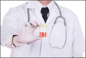 ما هي أسباب البيلة الدموية (الدم في البول) وكيفية علاجها - urinary-tract-health hematuriaي feat - ما هي أسباب البيلة الدموية (الدم في البول) وكيفية علاجها
