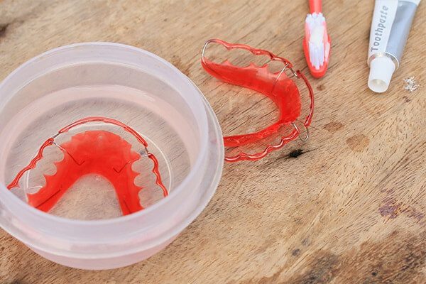 رعاية المثبّت: كيفية تنظيف مثبت الأسنان - oral-health how can retainers be cleaned at home - رعاية المثبّت: كيفية تنظيف مثبت الأسنان