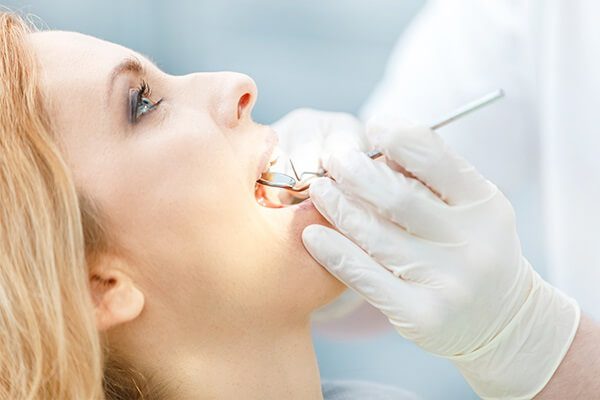 كيف يزيل أطباء الأسنان الأسنان؟