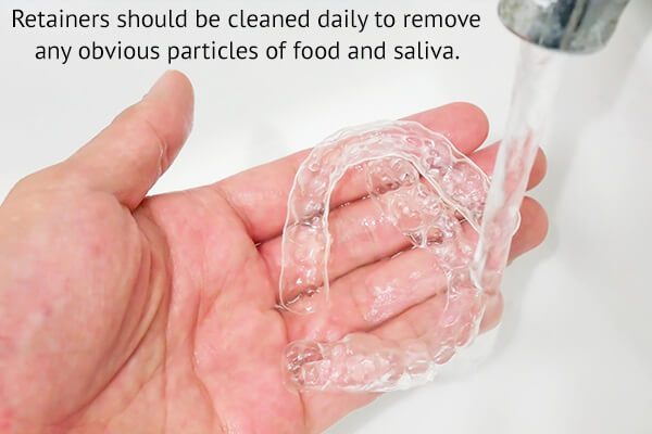 رعاية المثبّت: كيفية تنظيف مثبت الأسنان - oral-health how to clean retainers thoroughly - رعاية المثبّت: كيفية تنظيف مثبت الأسنان