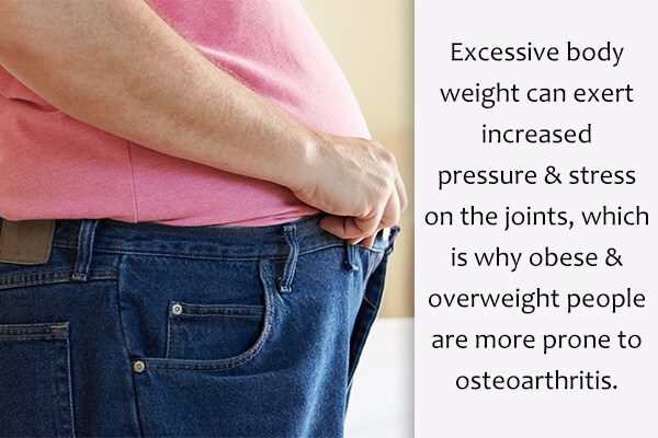 علاج الفصال العظمي : النظام الغذائي والرعاية الذاتية والعلاج الطبي - bones-joints osteoarthritis risk factors - علاج الفصال العظمي : النظام الغذائي والرعاية الذاتية والعلاج الطبي