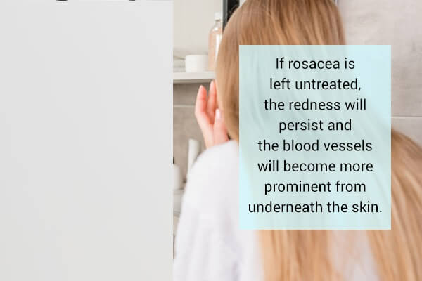 ما الذي يسبب الوردية وهل هي معدية؟ - skin-beauty rosacea what are the side effects - ما الذي يسبب الوردية وهل هي معدية؟