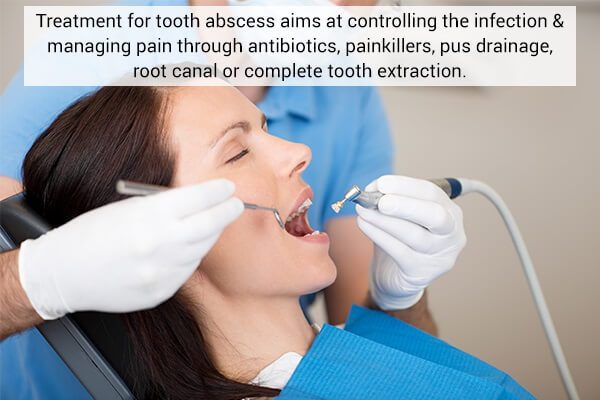 ما هو خراج الأسنان وعلاجه وكيفية منعه - oral-health tooth abscess standard medical - ما هو خراج الأسنان وعلاجه وكيفية منعه