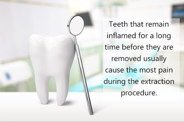 ما هي الآثار اللاحقة لاستخراج الأسنان؟
