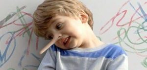 الكذب-عند-الاطفال-1-300x143 الكذب عند الأطفال وطرق علاجه والوقاية منة