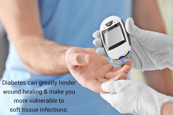 من يصاب بالتهاب النسيج الخلوي وكيفية علاجه؟ - skin-beauty cellulitis diabetics - من يصاب بالتهاب النسيج الخلوي وكيفية علاجه؟