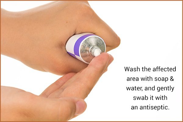 من يصاب بالتهاب النسيج الخلوي وكيفية علاجه؟ - skin-beauty cellulitis keep it clean - من يصاب بالتهاب النسيج الخلوي وكيفية علاجه؟
