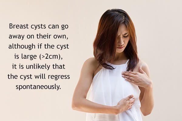 تكيسات الثدي : الأسباب والأعراض والعلاج والرعاية الذاتية - womens-health do breast cysts go away on their own - تكيسات الثدي : الأسباب والأعراض والعلاج والرعاية الذاتية