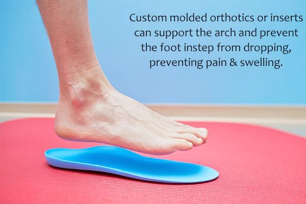 جراحة القدم المسطحة: نصائح التحضير والمخاطر والتعافي - bones-joints flat foot surgery non surgical treatments - جراحة القدم المسطحة: نصائح التحضير والمخاطر والتعافي