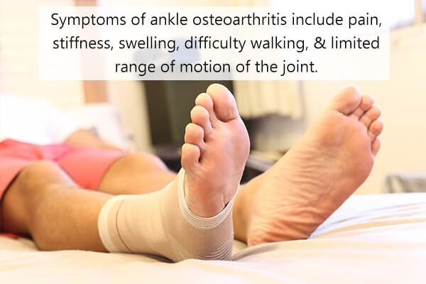 جراحة القدم: التعافي والمخاطر والفوائد والخيارات البديلة - bones-joints foot surgery ankle arthritis - جراحة القدم: التعافي والمخاطر والفوائد والخيارات البديلة
