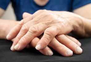 Polyarthrite rhumatoïde : tests, diagnostic, signes et traitement - os-articulations Douleur de la polyarthrite rhumatoïde - Polyarthrite rhumatoïde : tests, diagnostic, signes et traitement