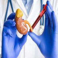 الكرياتينين , انخفاض مستوياتة , الاسباب وطرق العلاج الطبية والمنزلية - glands-hormones انخفاض مستوياتة الاسباب وطرق العلاج الطبية والمنزلية3 1 1 - الكرياتينين , انخفاض مستوياتة , الاسباب وطرق العلاج الطبية والمنزلية