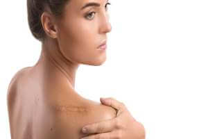 الندبة , طرق التخلص منها , الاسباب , طرق منزلية لعلاجها - skin-beauty طرق التخلص منها الاسباب طرق منزلية لعلاجها منها4 1 - الندبة , طرق التخلص منها , الاسباب , طرق منزلية لعلاجها