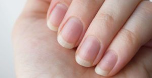تطويل الأظافر بشكل أسرع وأقوى , نصائح تمكنك من علاج الاظافر الهشة - skin-beauty الأظافر بشكل أسرع وأقوى نصائح تمكنك من علاج الاظافر الهشة1 1 300x155 - تطويل الأظافر بشكل أسرع وأقوى , نصائح تمكنك من علاج الاظافر الهشة