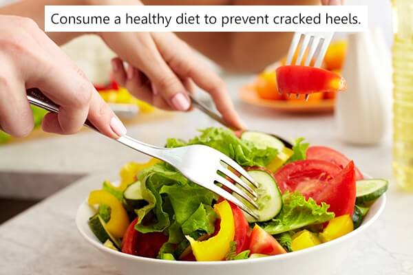 العلاجات المنزلية لشفاء الكعوب المتشققة - skin-beauty cracked heels consume a healthy diet - العلاجات المنزلية لشفاء الكعوب المتشققة