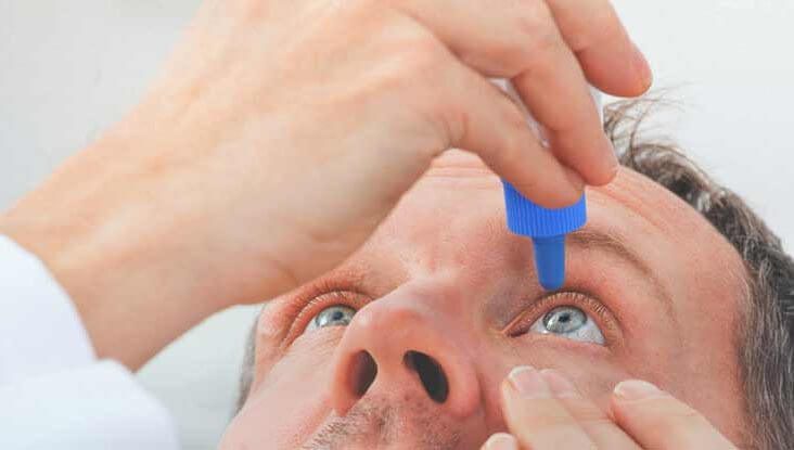 العين الوردية (التهاب الملتحمة) الأسباب والأعراض والعلاج - %categories