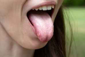 Langue Blanche Causes Symptomes Et Traitement Sweetest Haum