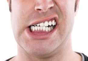صرير الأسنان (صريف الأسنان): العناية الذاتية والعلاج المنزلي - oral-health maloclusionبي 750x350 1 - صرير الأسنان (صريف الأسنان): العناية الذاتية والعلاج المنزلي
