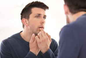 Ulcères de la bouche : types, symptômes et traitement - ORL les ulcères de la bouche provoquent un exploit - Ulcères de la bouche: types, symptômes et traitement
