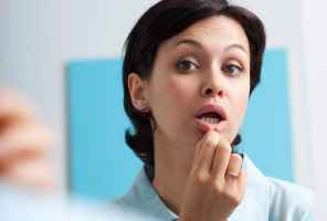 العلاجات المنزلية لقرحة الفم - oral-health mouth ulcerبs feat 1 - العلاجات المنزلية لقرحة الفم