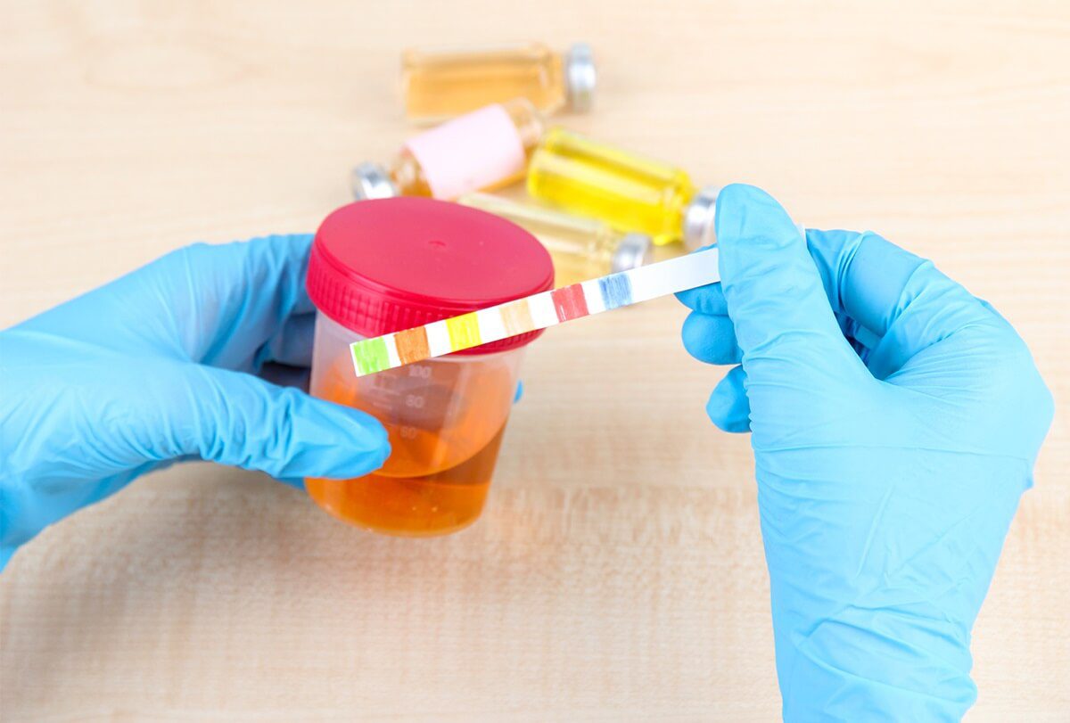 العلامات والأعراض التي قد تشير إلى مرض الكلى - urinary-tract-health ways to identify kidney disease feat - العلامات والأعراض التي قد تشير إلى مرض الكلى
