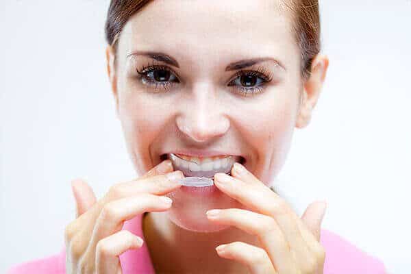 ما سبب اصفرار الأسنان وكيفية تبيضها - %categories