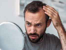الغدة الدرقية وتساقط الشعر: التشخيص والعلاج والرعاية الذاتية - glands-hormones a man experiencing hair loss because of a pro لار رblem with his thyroid - الغدة الدرقية وتساقط الشعر: التشخيص والعلاج والرعاية الذاتية