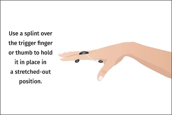 كيفية التعامل مع الإصبع الزنادي - %categories