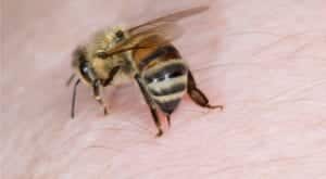كم يدوم انتفاخ لسعة النحل