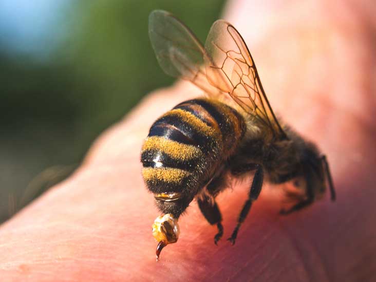 Combien de temps dure le gonflement des piqûres d'abeille? Combien de temps dure le gonflement des piqûres d'abeille?